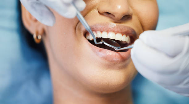 Best Emergency Dental Care for Broken or Chipped Teeth in Omao, HI