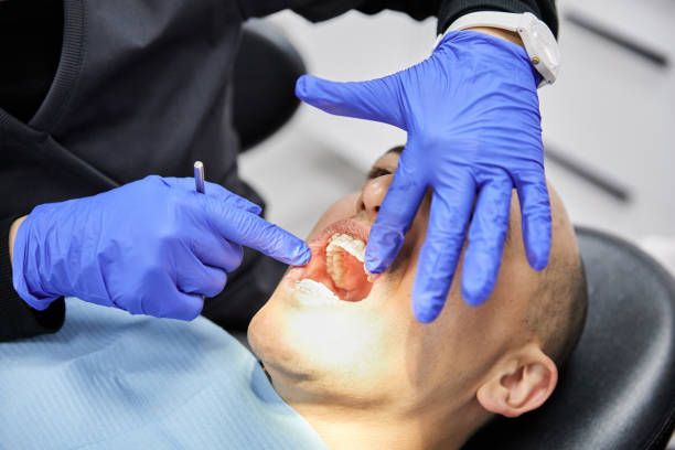 Best Emergency Dental Care for Broken or Chipped Teeth in Omao, HI
